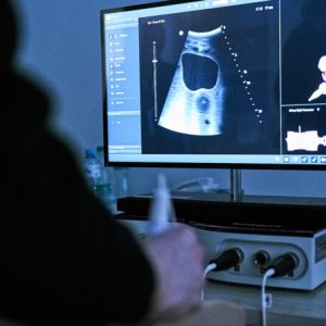 eFAST – ULTRA warsztaty dla studentów kierunków medycznych